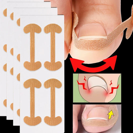 NailFlex Correction Strips
