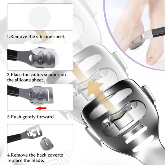 ProStep Foot Care Kit