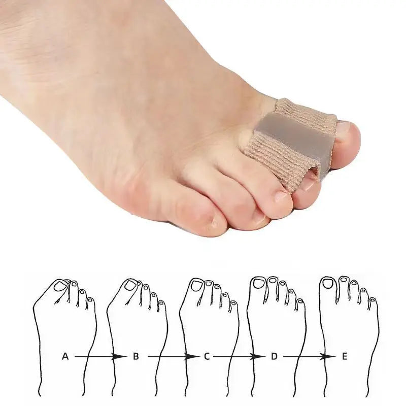 FlexToe Ring Corrector