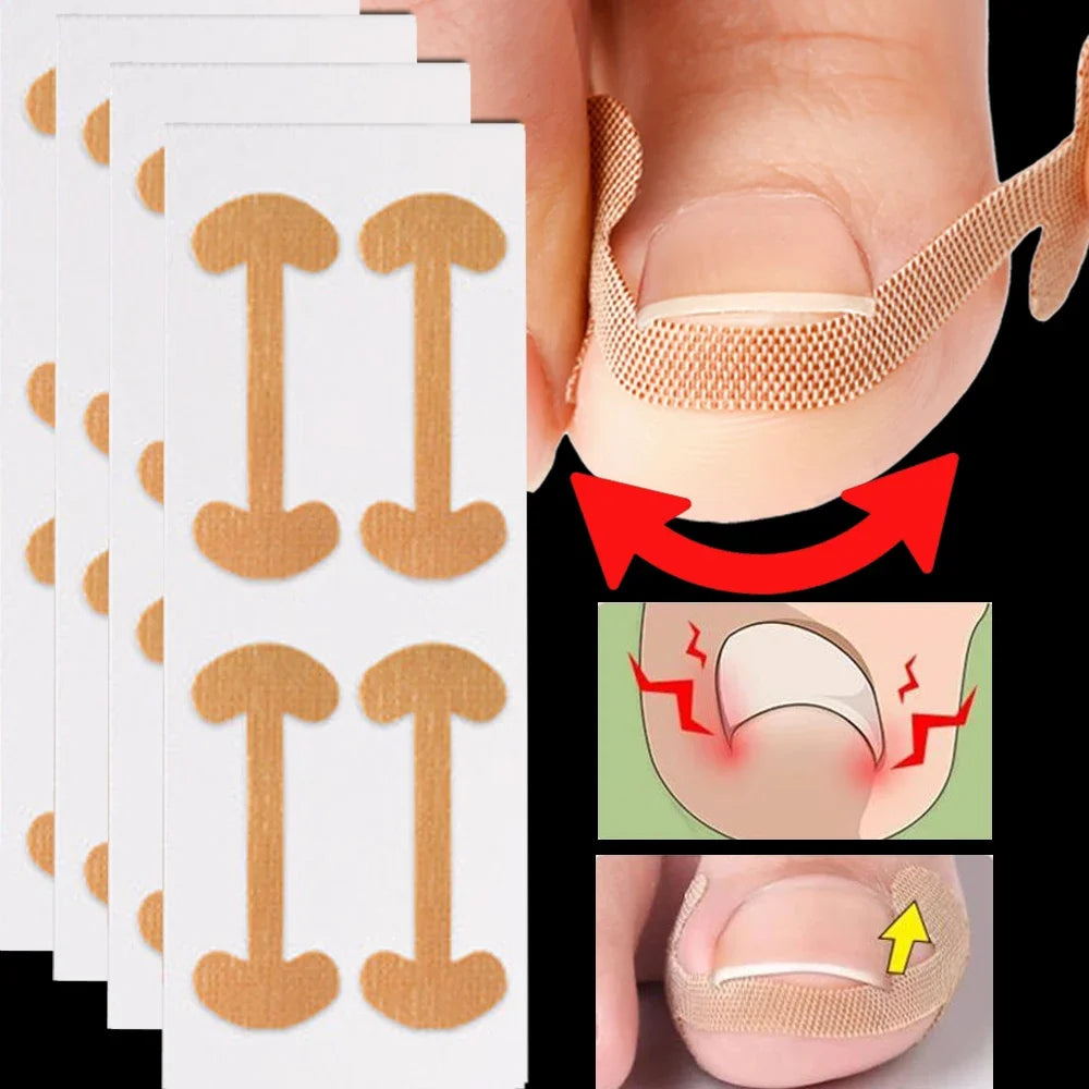 NailFlex Correction Strips