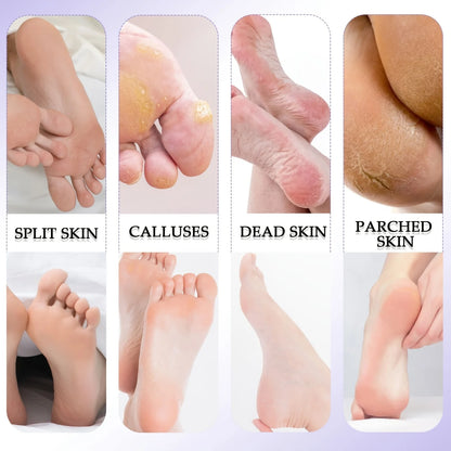 ProStep Foot Care Kit