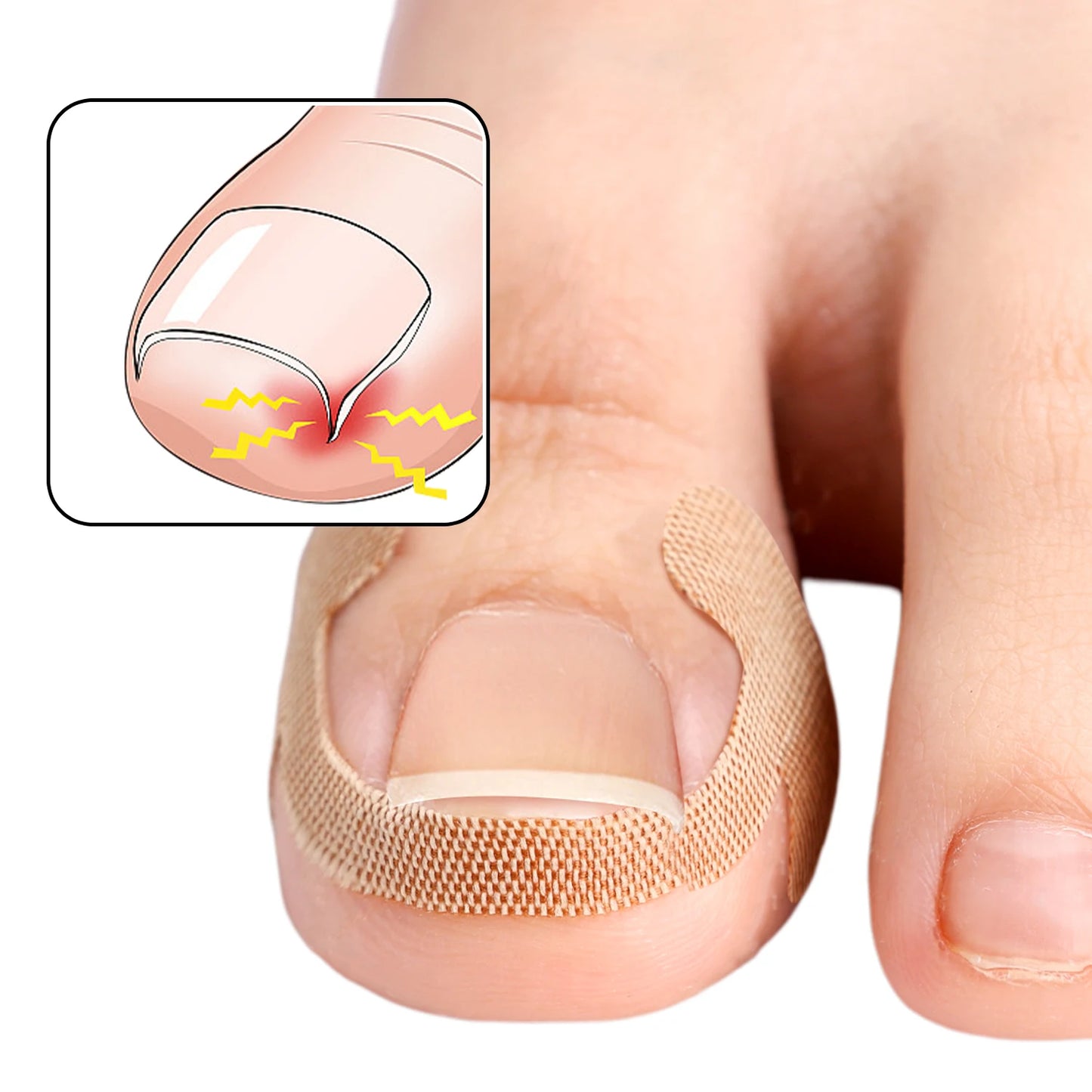 NailFlex Correction Strips