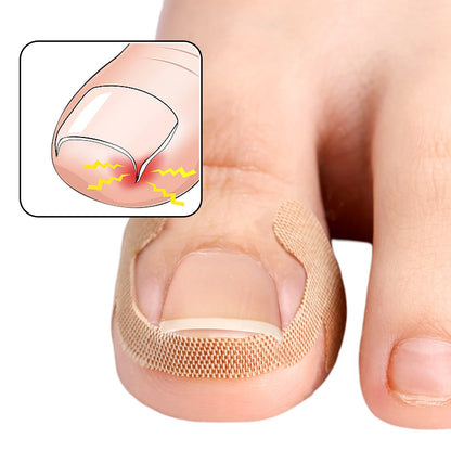 NailFlex Correction Strips