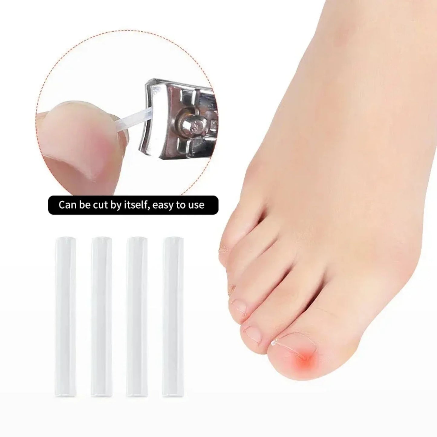 Nail Guard Straightening Patches