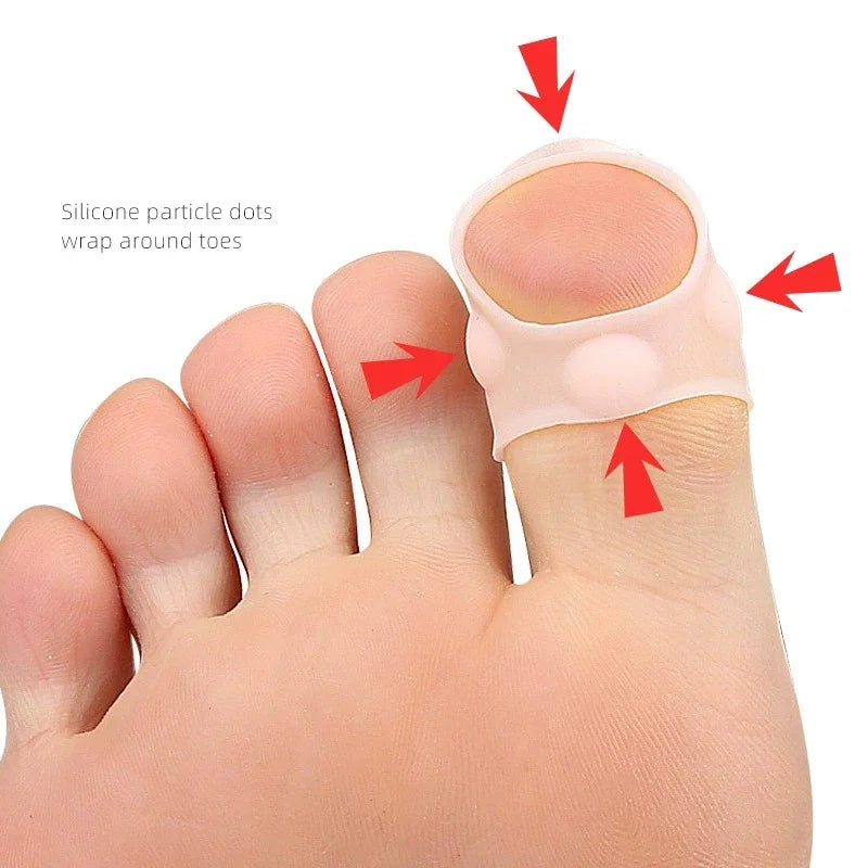ClearLift Nail Corrector