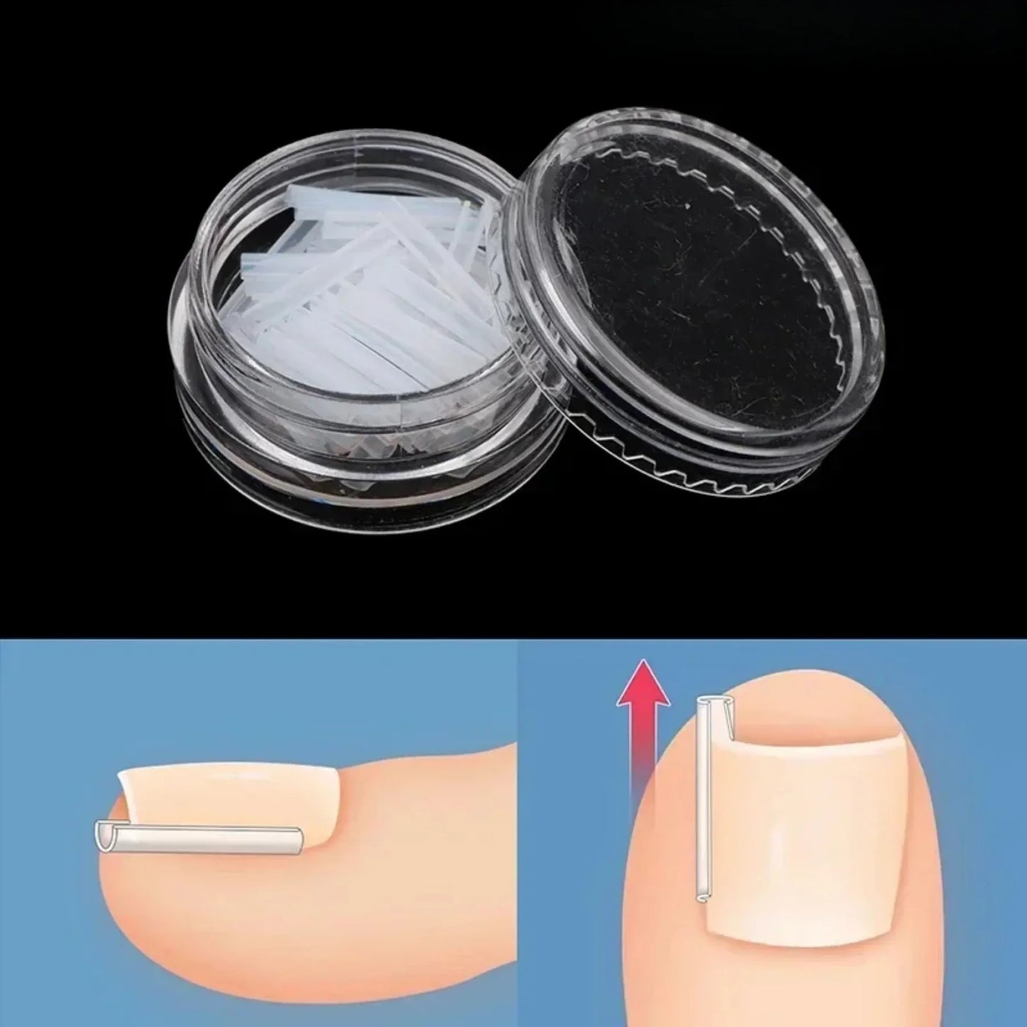Nail Guard Straightening Patches