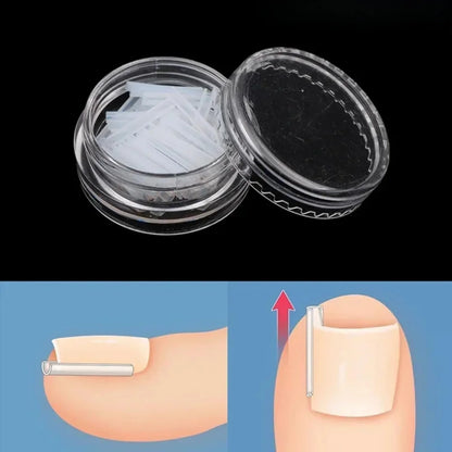 Nail Guard Straightening Patches