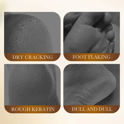 RiceGlow Foot Renewal Mask