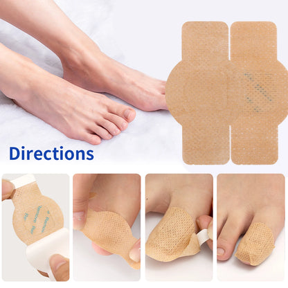 Fungal nail Patches
