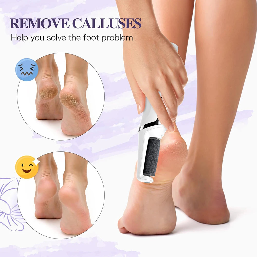 Electric Foot Callus Remover Portable Smooth Electric Foot File for Dry Cracked Dead Skin Remover Rechargeable Feet Care Kit