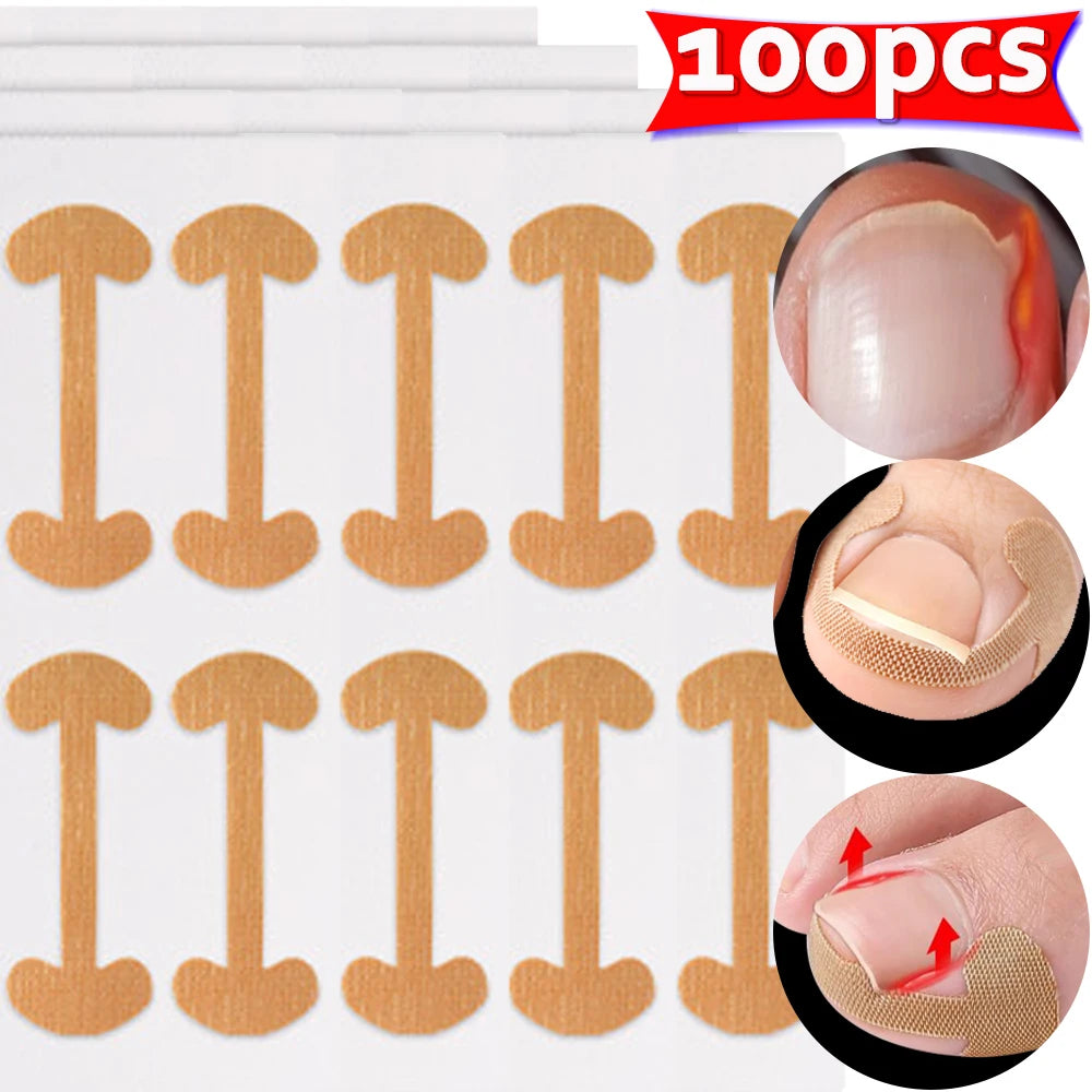 NailFlex Correction Strips