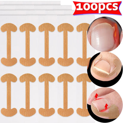 NailFlex Correction Strips