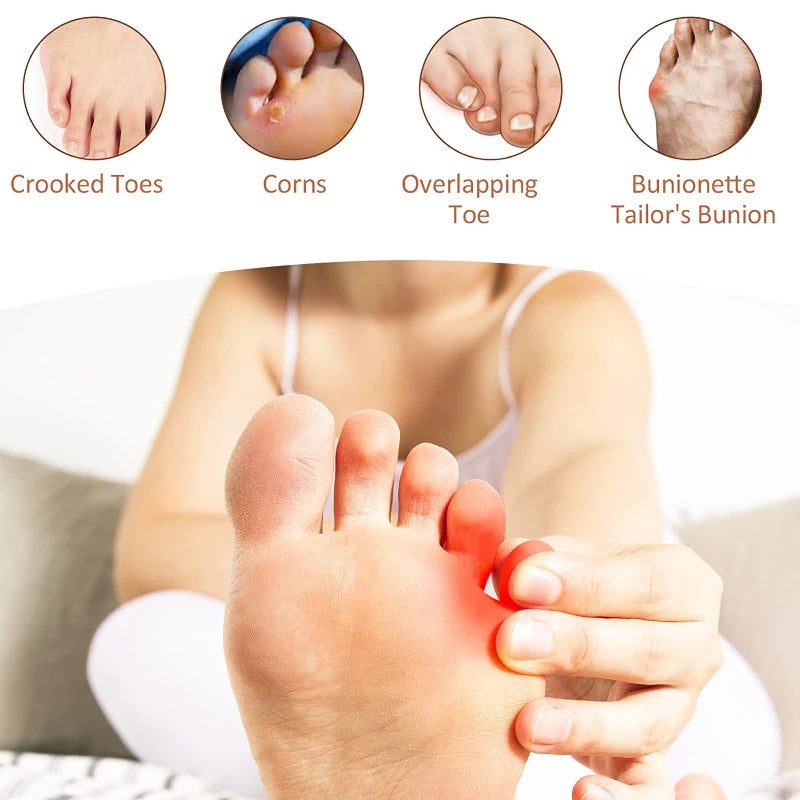 2pieces=1pair Little Toe Bunion Corrector Toe Strap Silicone Gel Hallux Valgus Cushions Spacer Feet Care Straightener Orthopedic