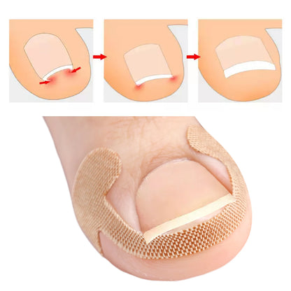 NailFlex Correction Strips