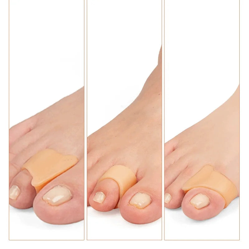 1/2/3/4Pairs Hammer Toe Straightener Hammertoe Finger Corrector for Curled Crooked Bent and Claw Toes Lift Toe Tip Toe Cushion